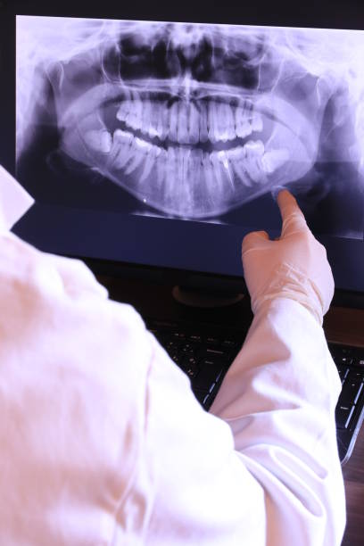 Best Knocked-Out Tooth (Avulsed Tooth) Treatment in Hudson, TX